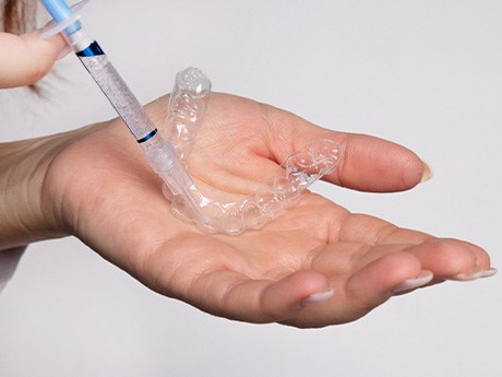 Hands applying whitening gel to applicator tray