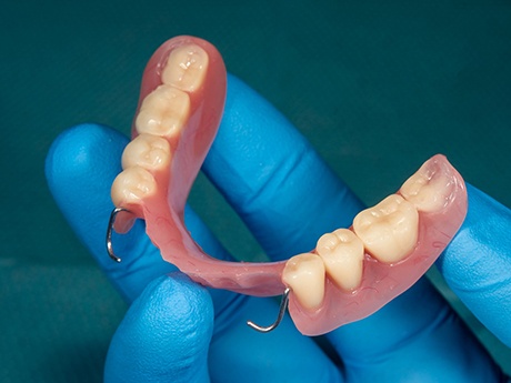 Dentist holding a set of partial dentures