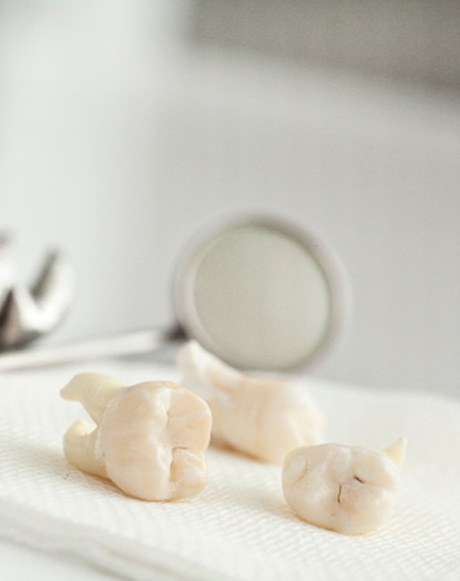 Removed teeth lying on a cloth