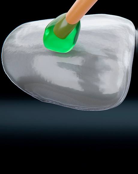 A 3D illustration of veneers in Marysville