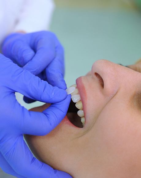 A woman getting dental veneers in Marysville